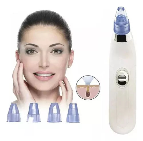 ClearPore Pro™ - Extractor De Puntos Negros